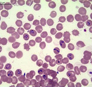 Hundemalaria Babesiose-rote Blutkörperchen